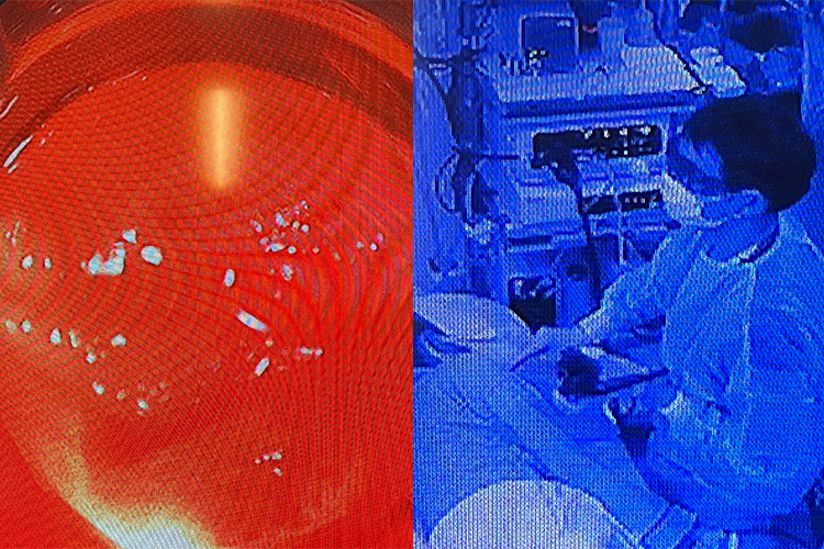 消化管グループ